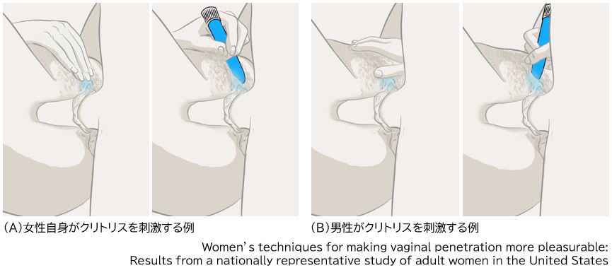 双重刺激：同时激活阴蒂背神经与阴道通路（图 32）